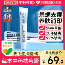 正品草本祛痘痘印药膏消炎修复淡化去痘坑痘疤青春期豆豆学生男士