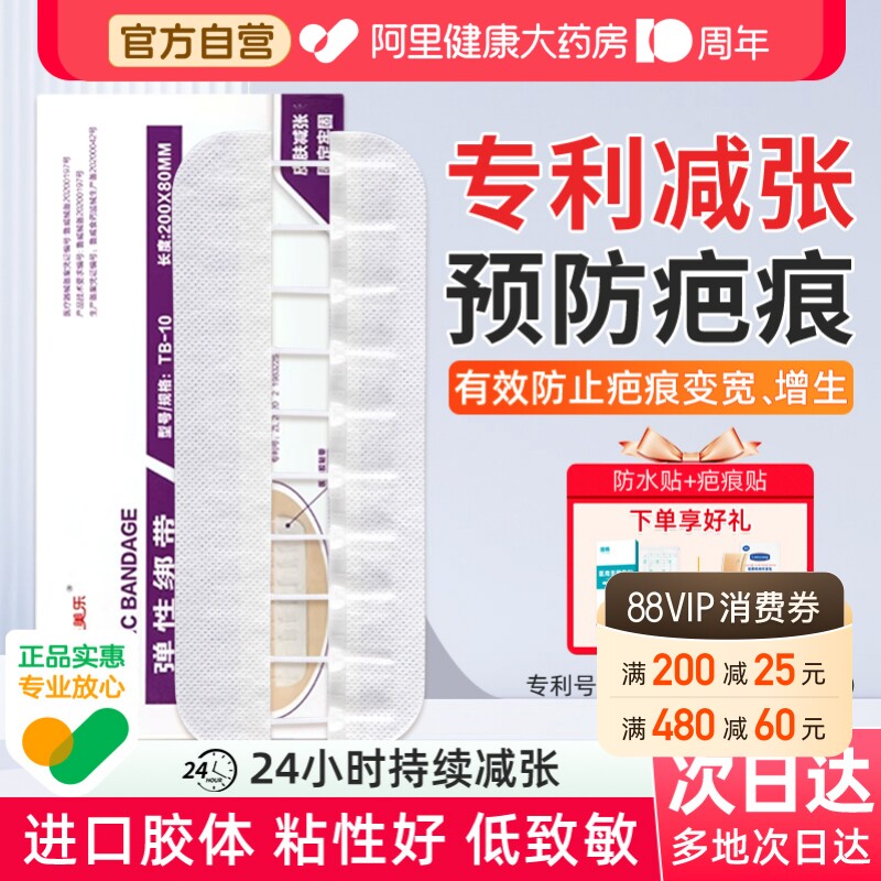 施美乐医用减张器剖腹产减张贴甲状腺术后疤痕减张器拉链式免缝合