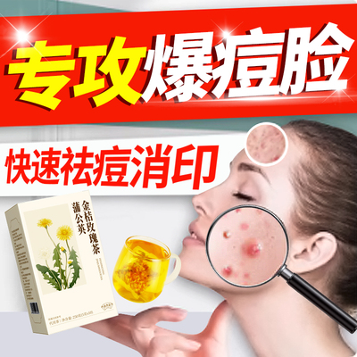 胖东莱严选蒲公英祛痘茶