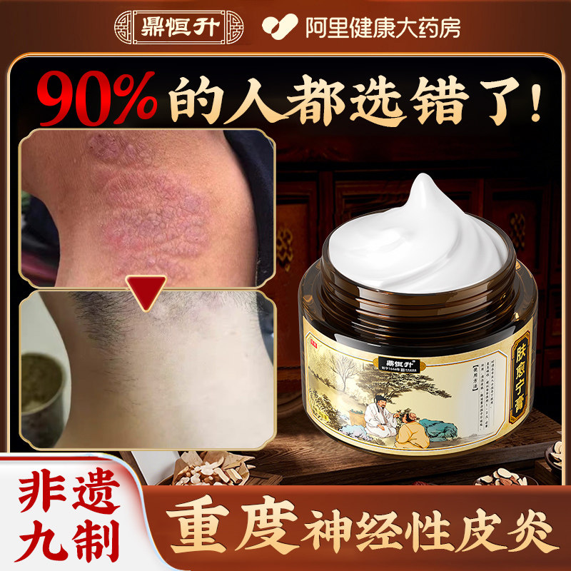 神经性皮炎特顽固效止痒的治外用膏疗专用皮肤藓湿真菌感染膏眼皮