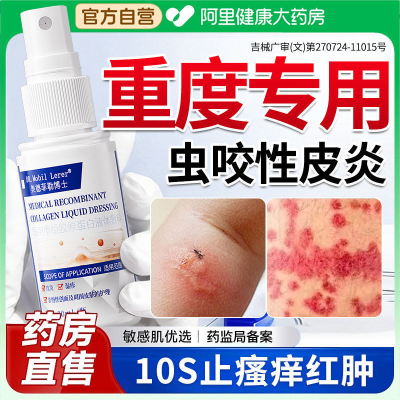 虫咬性皮炎药膏特毒虫蚊虫臭虫螨虫床虱瘙痒叮咬咬伤丘疹性荨麻疹