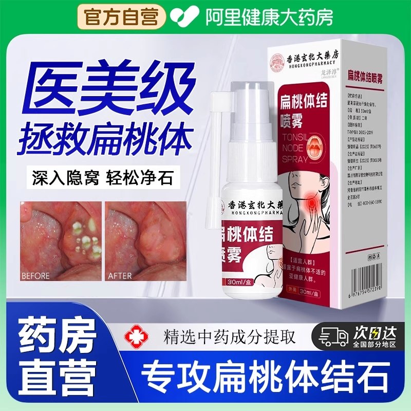 扁桃体结石漱口水口臭喷雾喷剂去除工具隐窝冲洗器电动吸取引清理