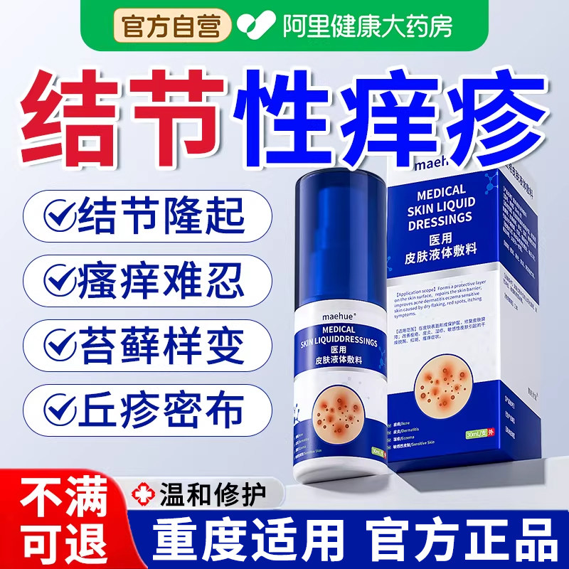 结节性痒疹特治顽固手上长红硬疙瘩皮肤瘙痒止痒除抑菌膏专用