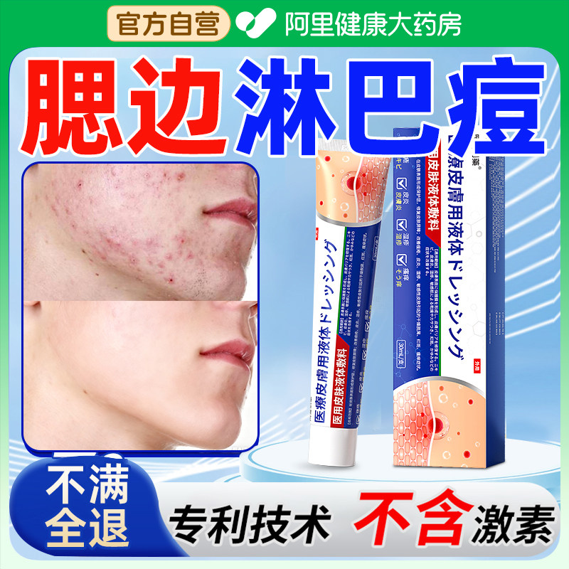 淋巴痘腮边下巴脖子反复长痘痘硬块痤疮上脸颊两边结节玫瑰医用