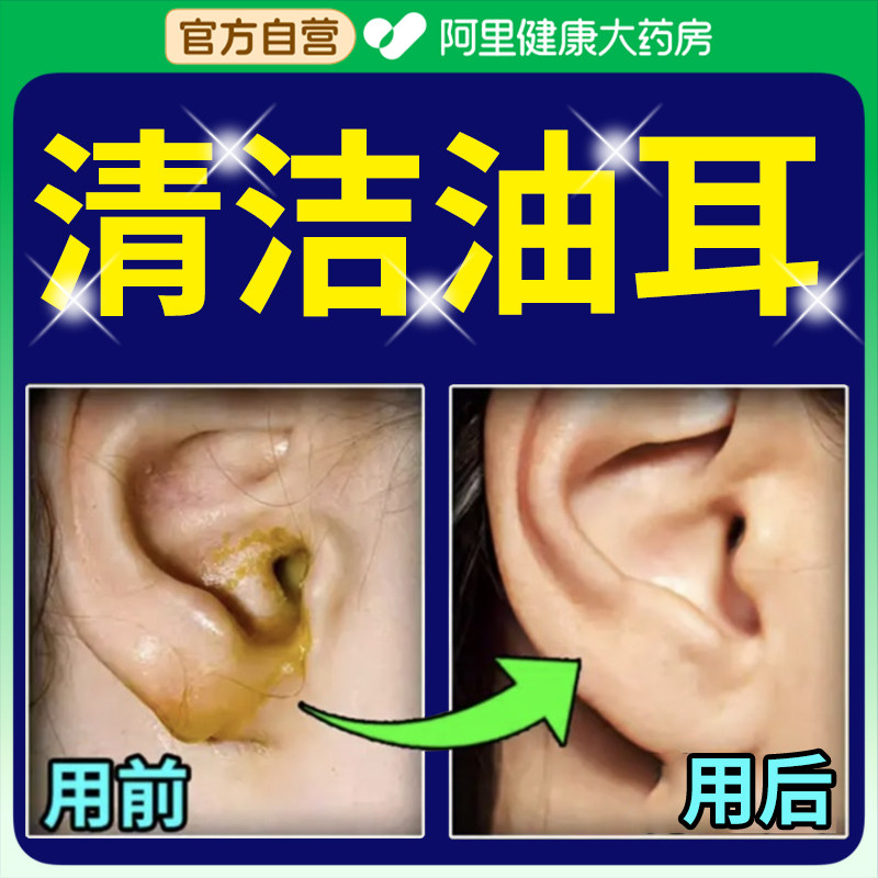 油耳朵清洁器发炎咽鼓管堵塞粘湿耳屎止痒吸油抑菌医用滴耳液耳鸣