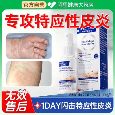 特应性皮炎软膏儿童专止痒湿疹药膏顽固性根皮肤瘙痒用过敏皮疹
