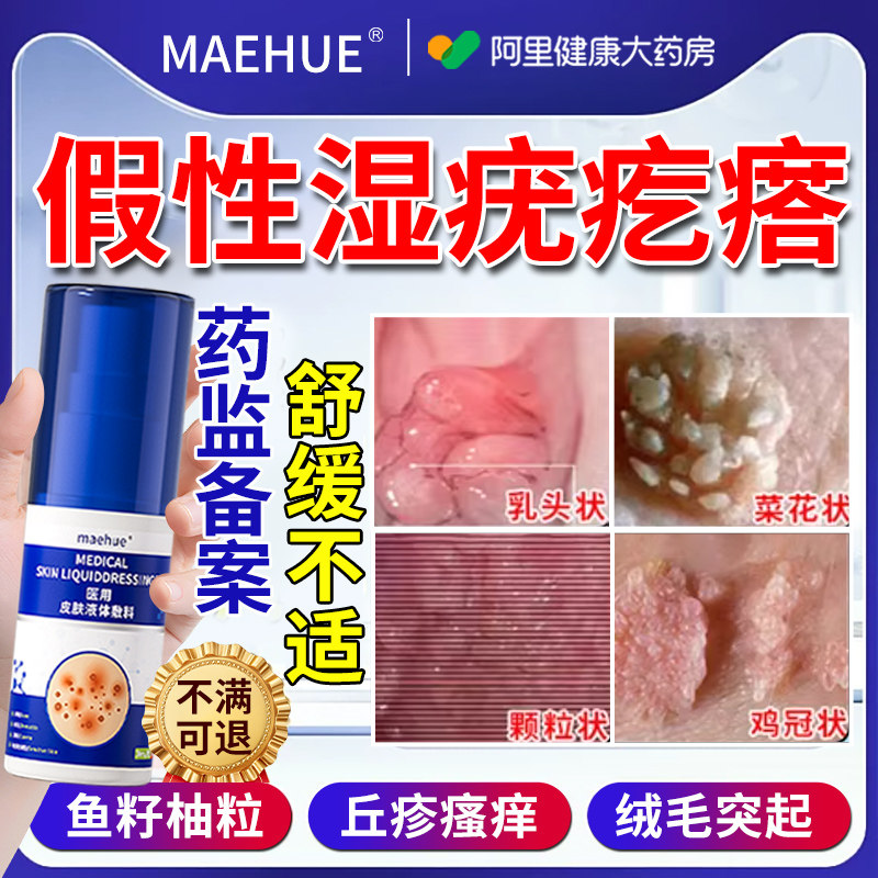 女性假性尖锐湿疣私处外阴有小疙瘩治阴道内阴瘙痒药膏止痒