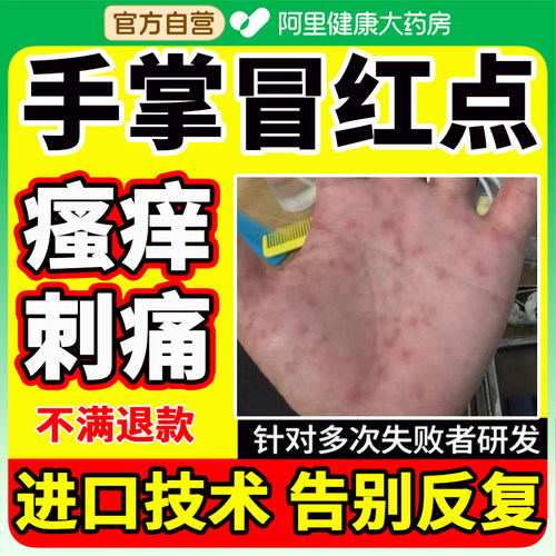 进口治疗除外用软膏痒刺痛抑菌药膏去泡湿