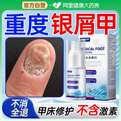 银屑病甲指甲细真菌感染专脱甲用发黄特增厚凹凸不平修复效液药房