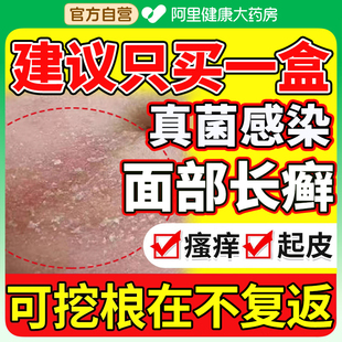 嘴角下巴脸上长癣干燥起皮红痒溢脂性皮炎面部有碎屑泛红皮肤过敏