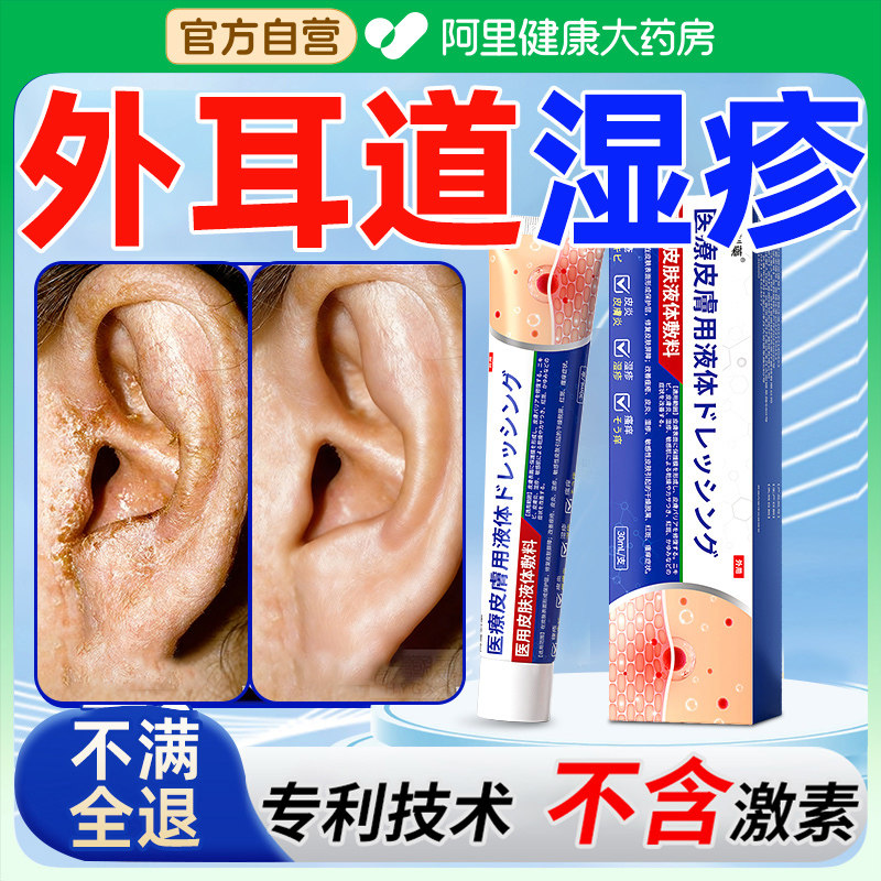 外耳道炎湿疹耳朵痒真菌感染止痒去领和根真菌性药房同售耳道抑菌