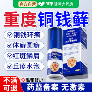 铜钱癣体癣真菌感染去皮肤癣股藓杀菌止痒膏顽固性瘙痒药膏效湿疹