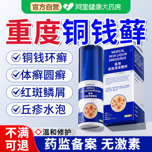 铜钱癣体癣真菌感染去皮肤癣股藓杀菌止痒膏顽固性瘙痒膏效专用