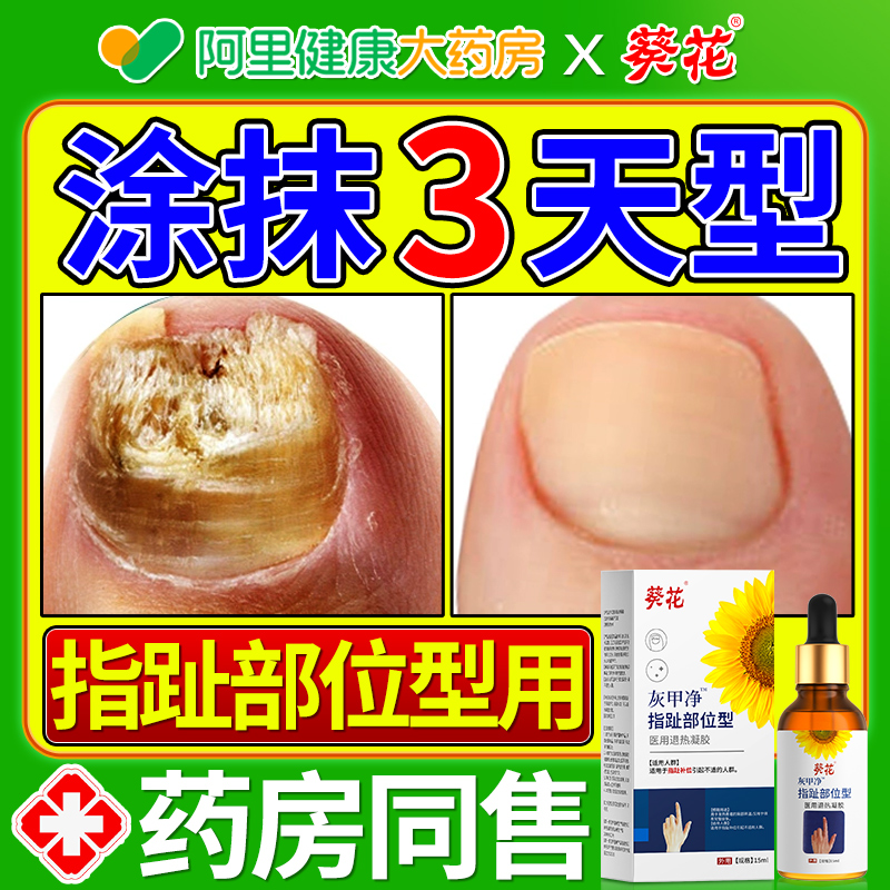 【阿里自营】灰甲专用温和换新甲