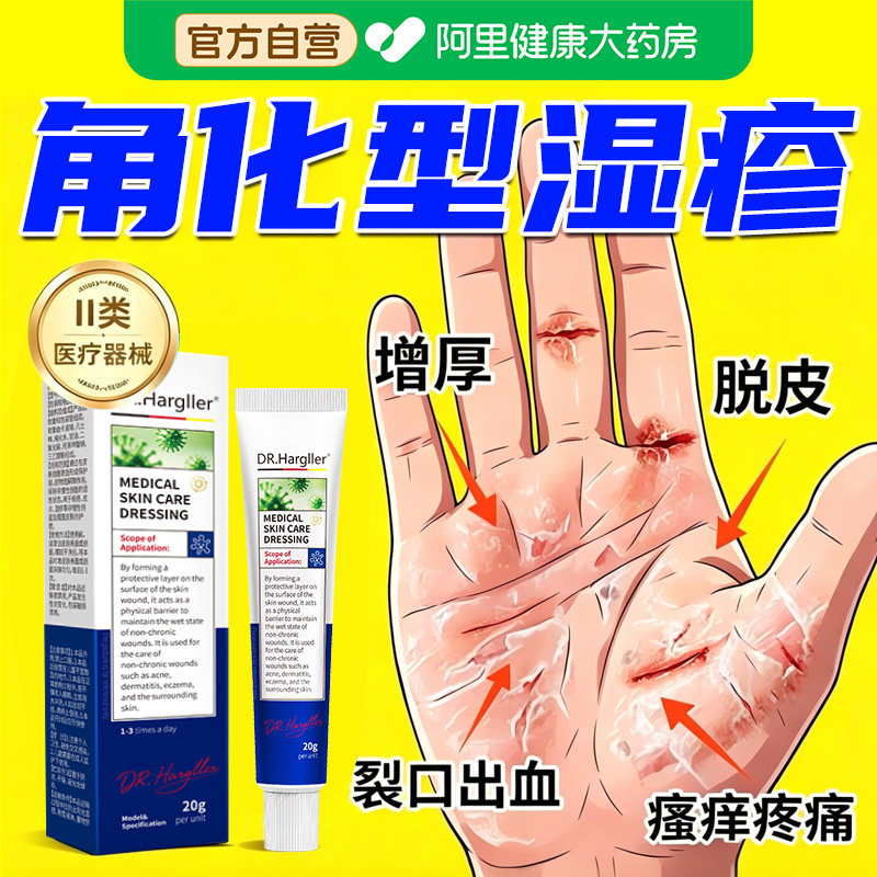 手部角化型湿疹脱皮干裂真菌感染专用非手足癣癣膏药膏皮肤图片