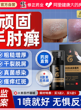 手肘癣手臂胳膊顽固性湿疹过敏神经性皮炎干燥起皮真菌感染止痒膏