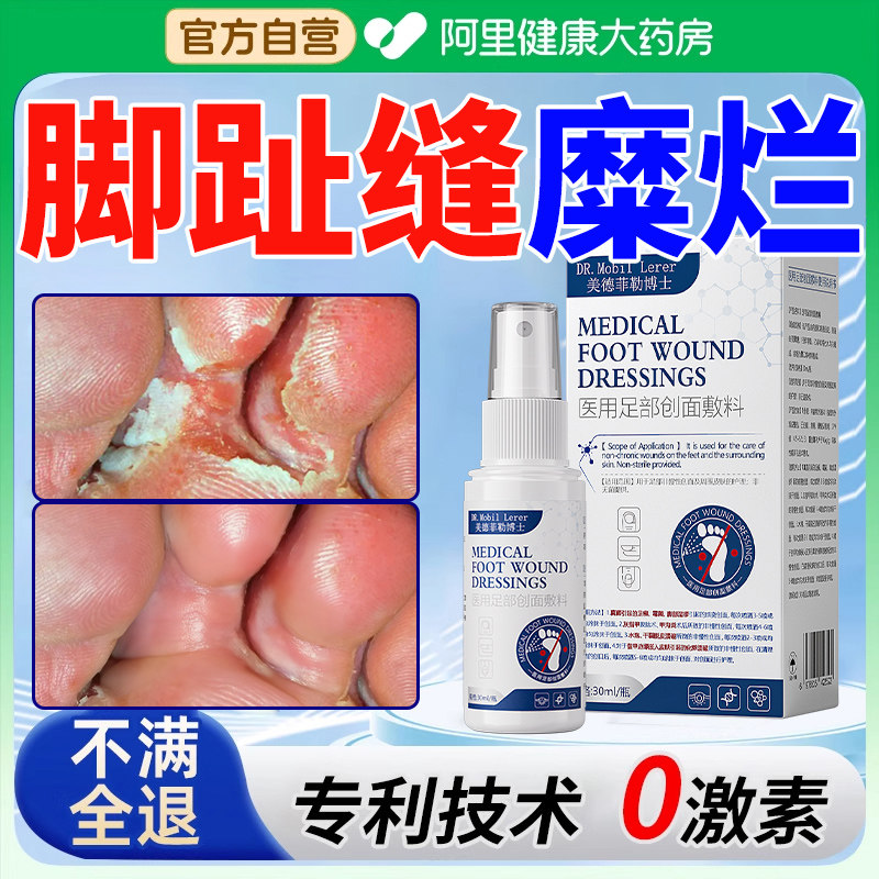 脚气脱皮糜烂脚趾缝真菌感染脚丫喷雾克星脚烂痒开裂水泡型的药