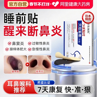 医用鼻炎贴儿童成人急慢性过敏鼻炎鼻窦炎鼻塞特效一贴通气鼻敏贴