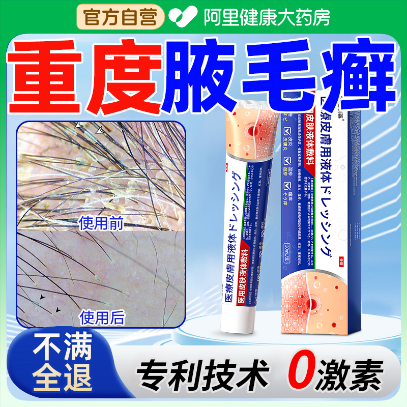 腋毛癣白色附着物腋下藓清洁胳肢窝出汗污垢红肿瘙痒异味去狐臭男