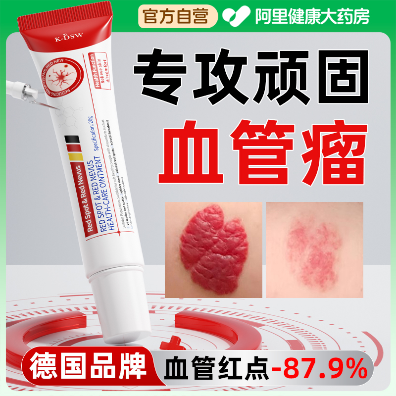 别忽视！血管痣小红点