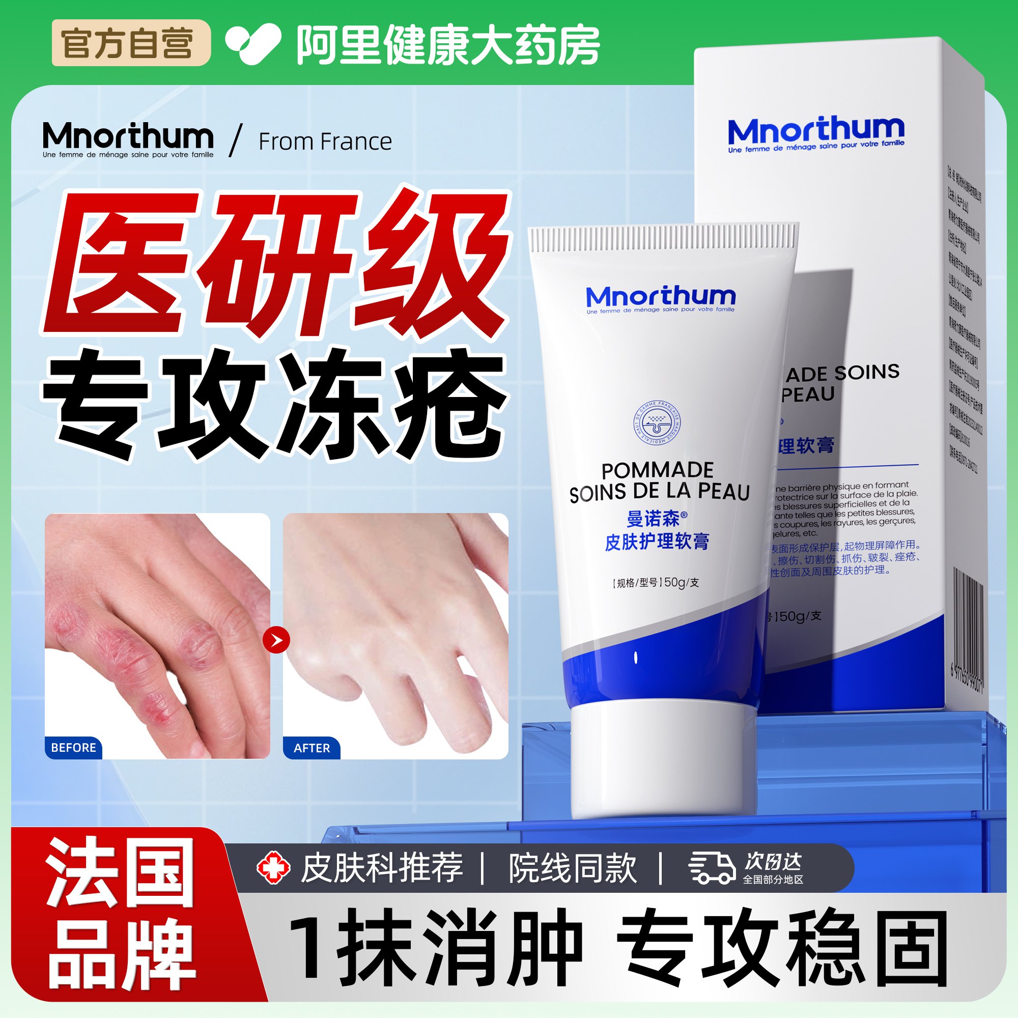 冻疮膏止痒冻伤膏医用特效防冻裂儿童耳朵护手足霜正品官方旗舰店