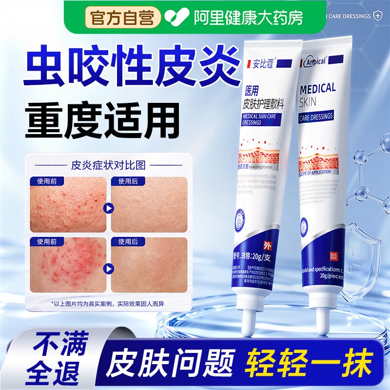 虫咬性皮炎毒虫蚊虫叮咬瘙痒止痒膏丘疹快消肿过敏药膏神器湿疹