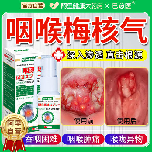 梅核气专用药喉咙有异物感痰多吐不完喷雾干咳嗓子梅核气痰湿重