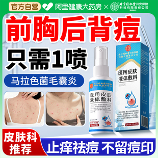 马拉色菌毛囊炎特效膏治疗前胸后背部长痘疙瘩除螨祛痒专用喷雾剂