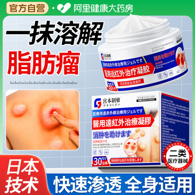 皮下脂肪瘤消瘤膏多发性纤维瘤康肿硬块囊肿皮脂腺去除神器专用膏