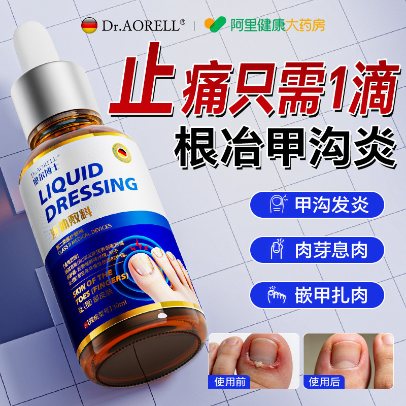 甲沟炎医用灰指甲滴剂嵌甲特专用软化治息肉去除效膏液消肿化脓疗