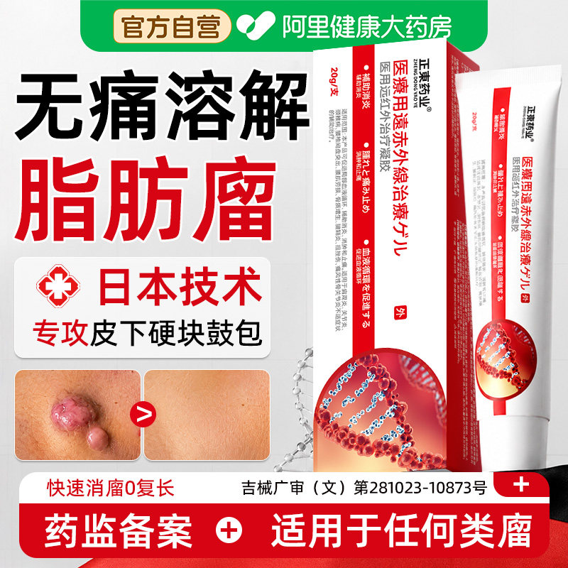 脂肪消瘤膏正品皮下鼓包硬块皮肤纤维瘤去除药膏肉粒疙瘩结节囊肿