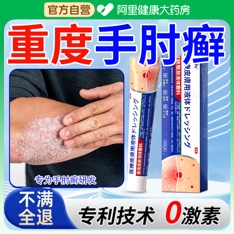 手肘癣手臂胳膊肘肚皮后背顽固性皮癣过敏神经性皮炎搭止痒膏