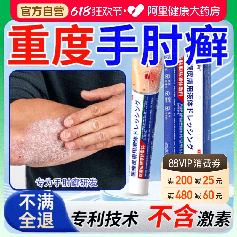 手肘癣手臂胳膊肘肚皮后背顽固性皮癣过敏神经性皮炎搭止痒膏