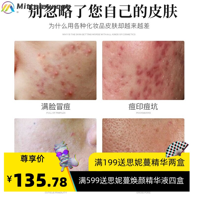 暨大修复祛痘冻干粉淡化痘印痘坑修护逗肌补水保湿精华美容院厂家