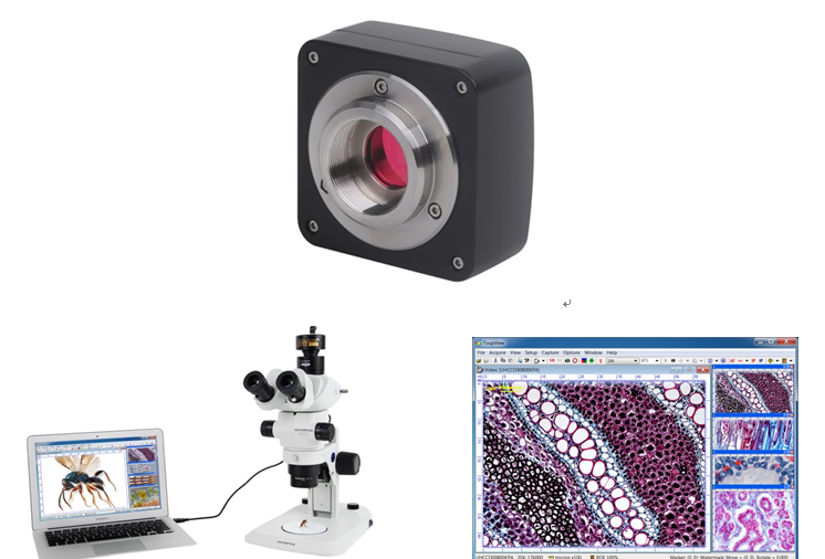 摄像头数码电子目镜
