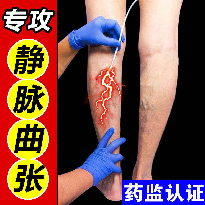 脉舒宝静脉曲张膏贴正品专用平治护具（器械）