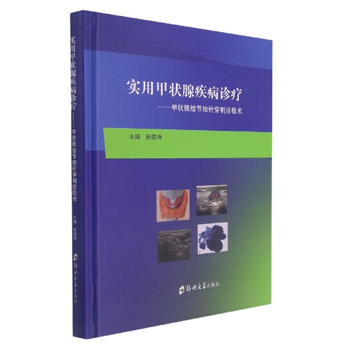 实用甲状腺疾病诊疗--甲状腺结节细针穿刺活检术(精)
