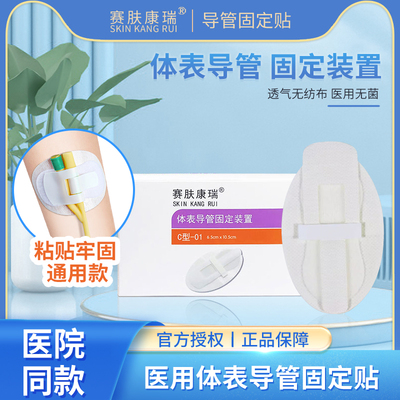 赛肤康瑞医用体表导管固定装置