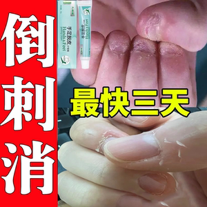 儿童手长倒刺手指肉刺滋润去肉刺死皮甲旁防撕手皮儿童手足脱皮膏