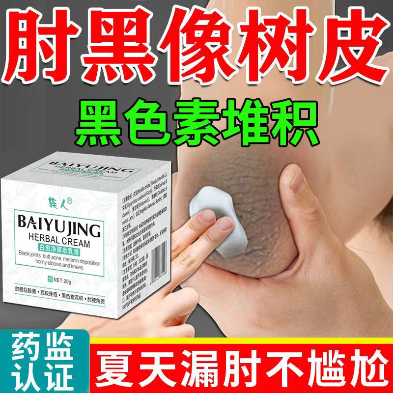 腋下去黑美白腋窝黑色素脖子沉淀去除磨砂膏膝盖手肘除黑沉着祛黑
