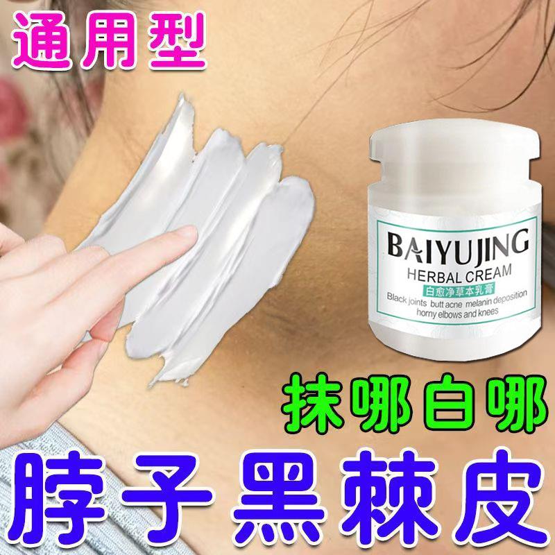 脚踝发黑脚脖黑色素沉淀去除腋下脖子膝盖手肘黑棘皮晒黑快速变白