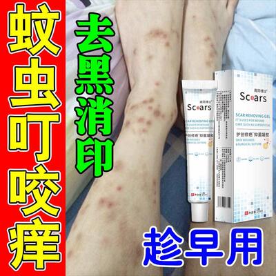 腿上挠印痘印伤烫疤痕蚊虫叮咬去黑印淡化黑色素沉淀去豆疤印消印