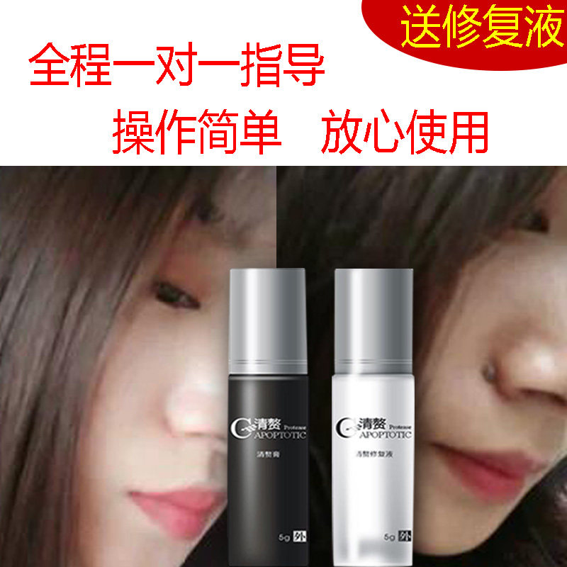 医美霖套装无痕去痣美容院点痣膏