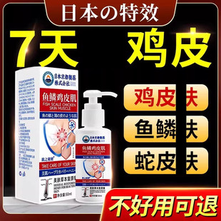 日本京都鸡皮肤疙毛囊角化瘩去角质身体霜乳磨砂膏身体嫩白全身美
