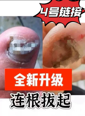 灰-指-甲增厚空甲甲萎缩指甲凹凸变黄甲浑浊甲克奇