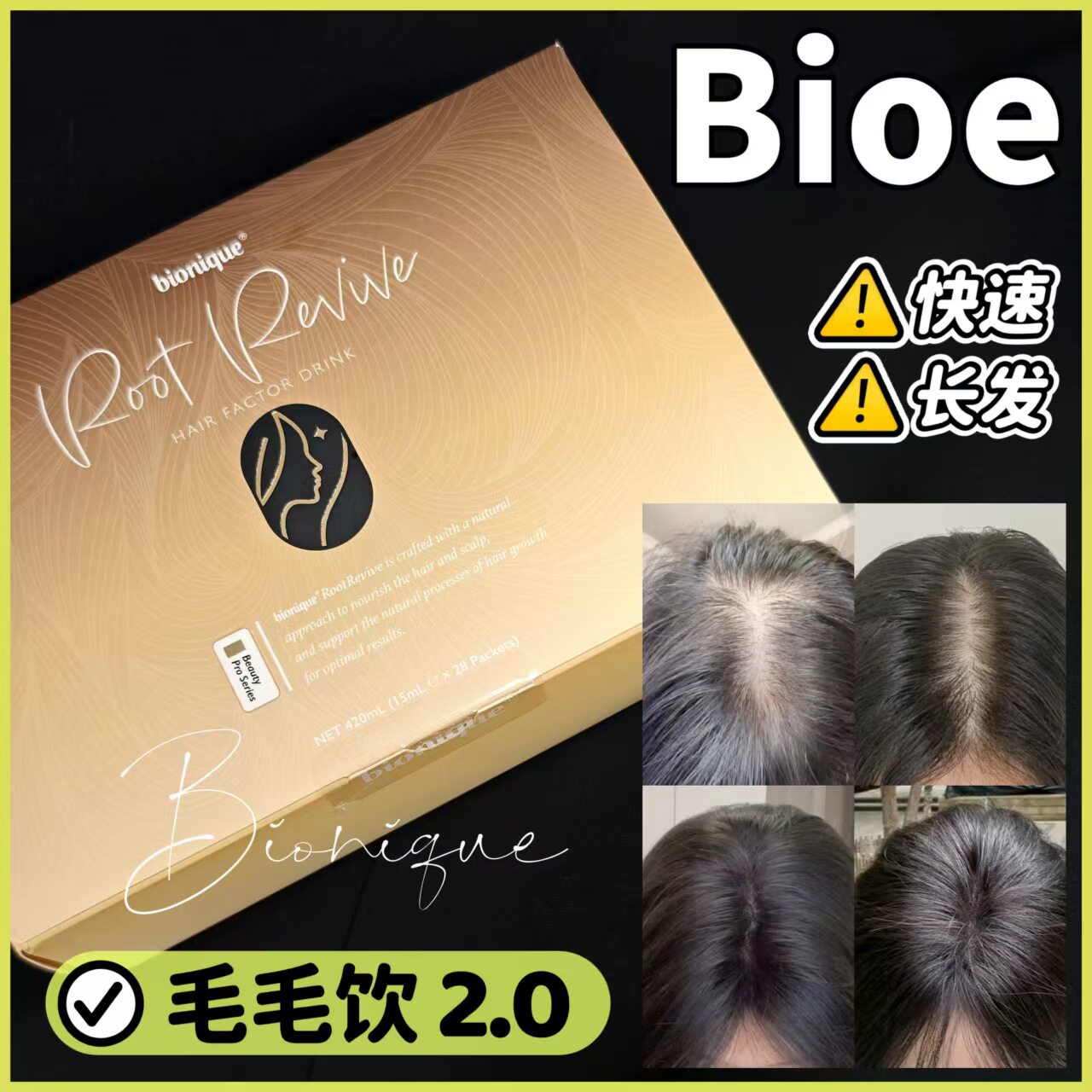 澳洲bioe毛毛饮2.0bionique多发饮男女头发饮口服黑发乌发精华液