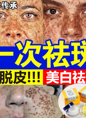 柔迪脱皮美白祛斑霜王去黄褐斑雀斑淡化色斑官方旗舰店正品第一名