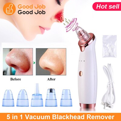 Vacuum Blackhead Remover Acne Pore Suction Face Cleaner USB