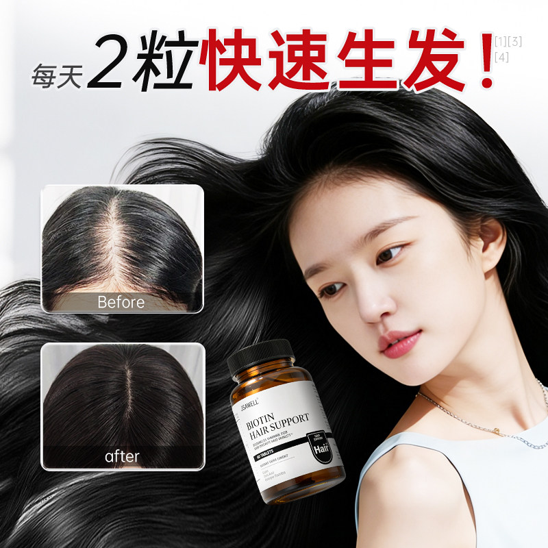 快速生发】不返脱M型O型