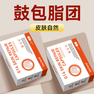 【专利款】LaCture皮脂助皮下脂包肿硬块鼓包溶解特效药原装进口